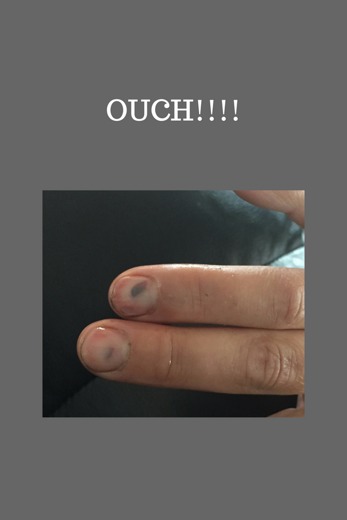 Ouch!!!  F%$#$% S%^&@#